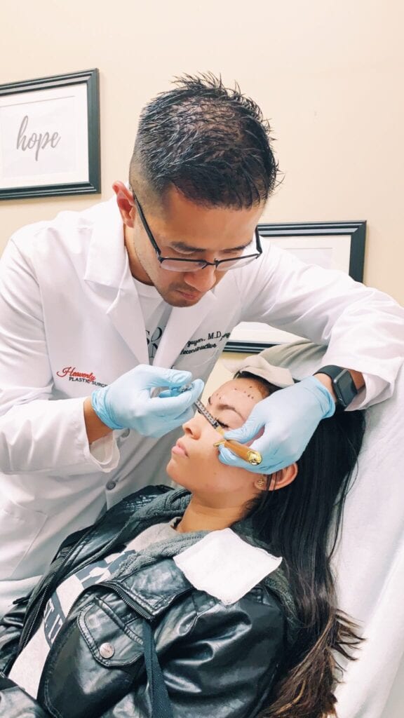 Dr. Nguyen injecting Botox into the glabella, forehead, and crow's feet.