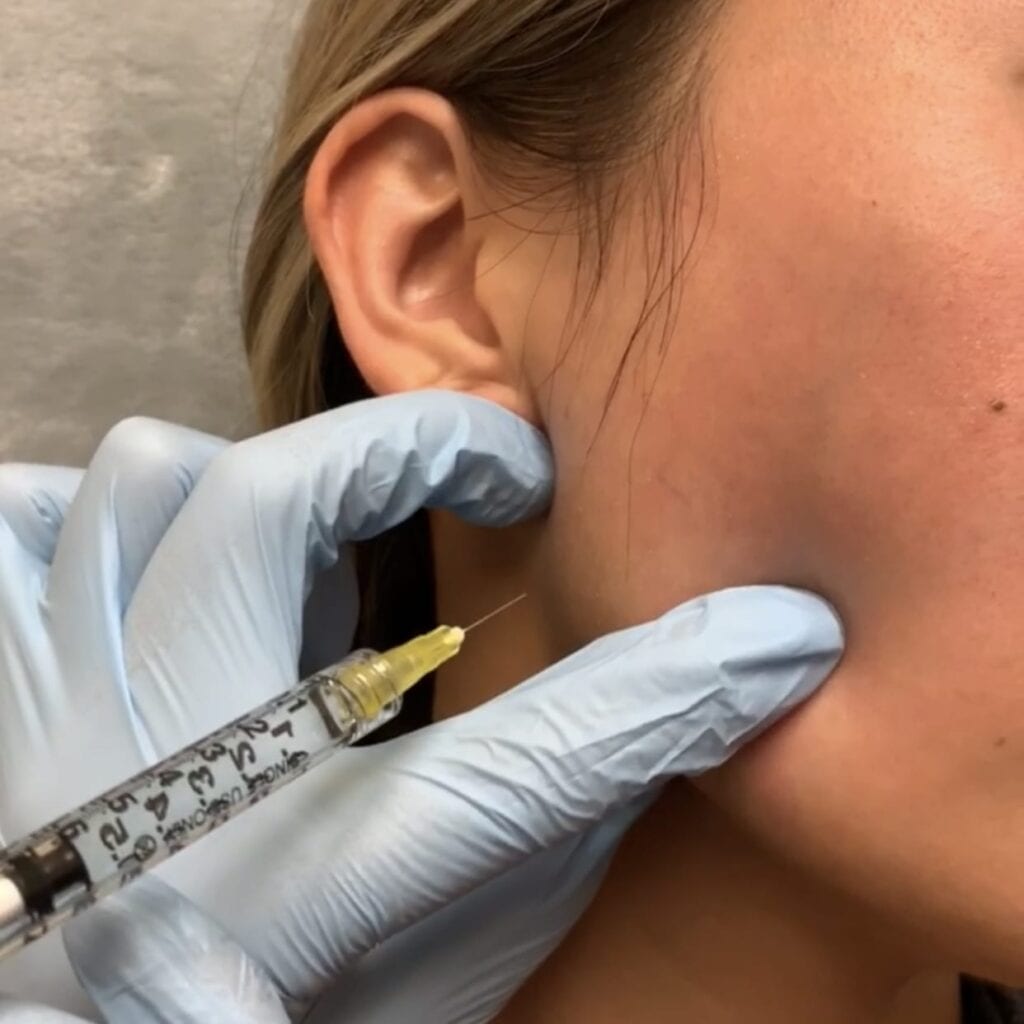 Dr. Nguyen injecting Botox to help slim the masseter (jaw) muscles.